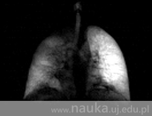 Nowe światło na diagnostykę płuc